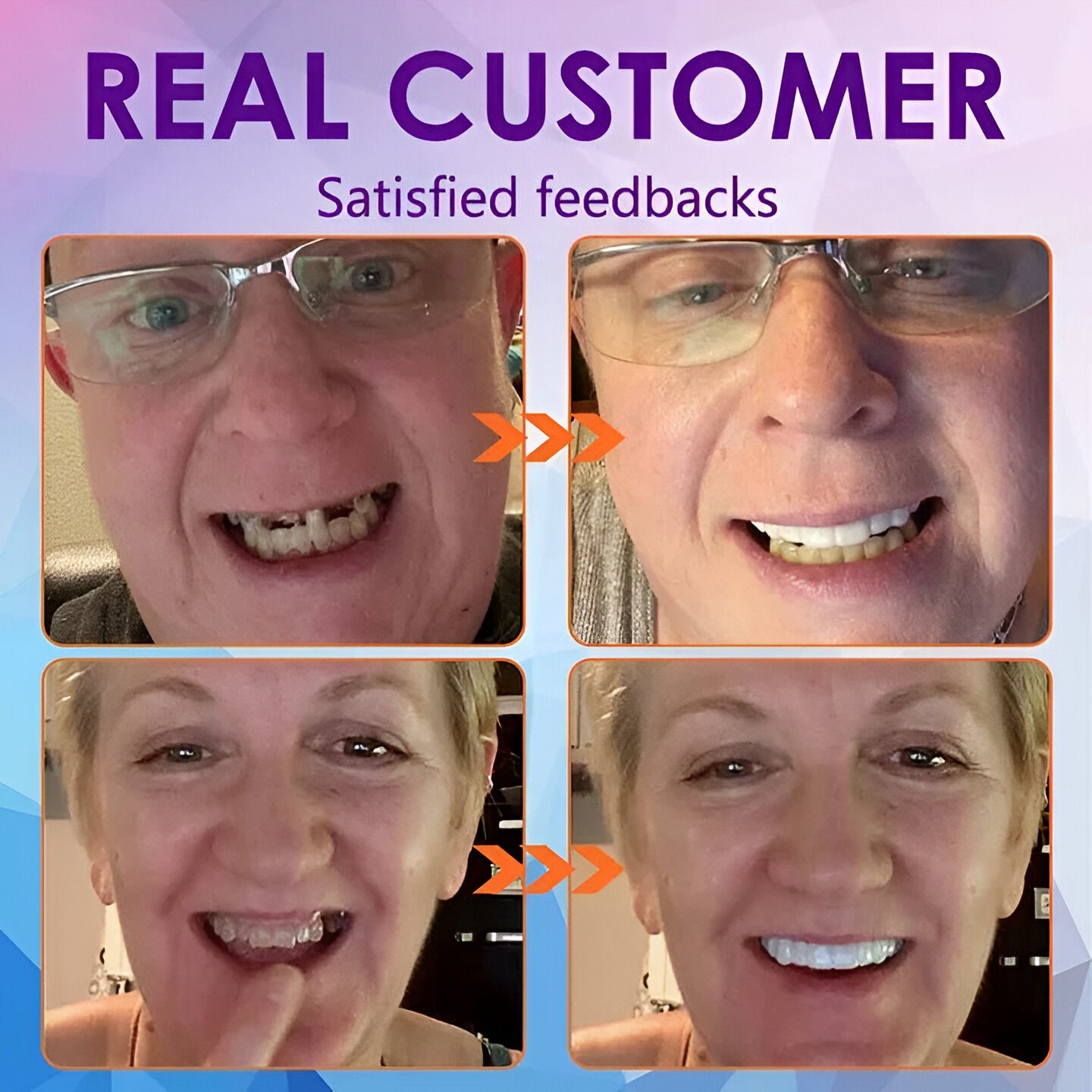 Evantory™ - Denture Set